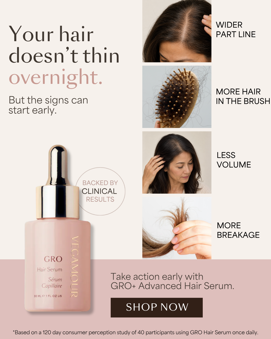 Vegamour GRO+ Advanced Hair Serum ad showing early hair thinning signs